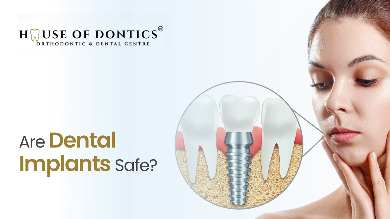 are dental implants safe