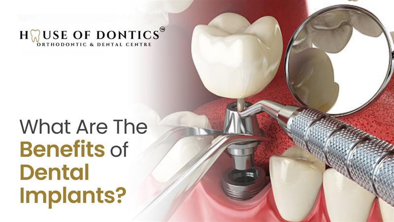 Dental Implant Procedure