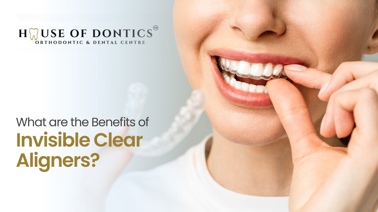 Invisible Clear Aligners