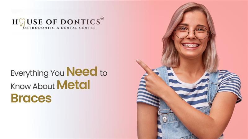 Dental Implant Procedure