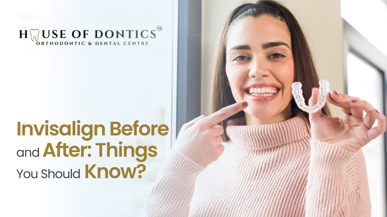 Dental Implant Procedure
