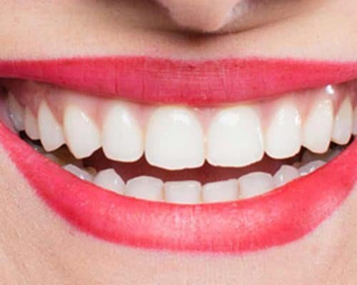  Enhance Your Smile and Boost Your Self-Image with a Smile Makeover