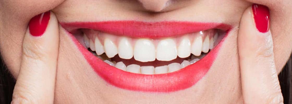  Enhance Your Smile and Boost Your Self-Image with a Smile Makeover