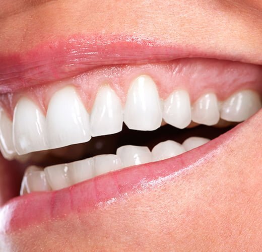 best-gums-surgery-in-ahmedabad