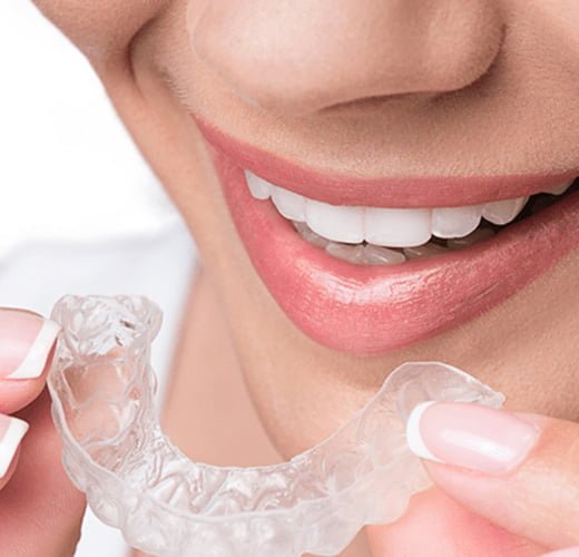 best-mobile-teeth-solution-with-splinting-in-ahmedabad