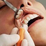 deep-cleaning-treatment-in-gujarat