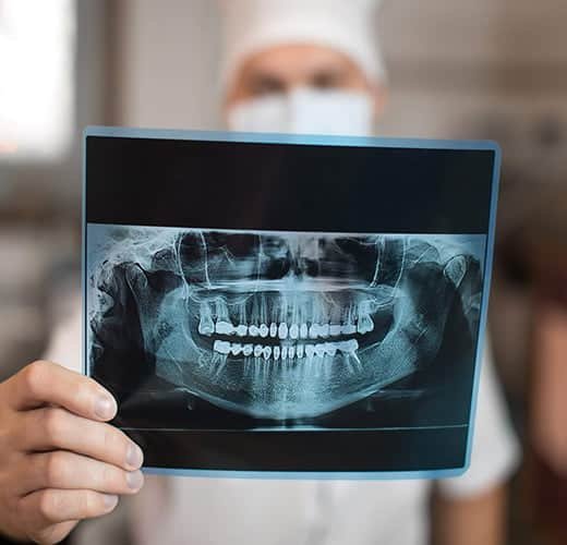 digital-full-mouth-panoramic-X-ray-treatment-in-ahmedabad